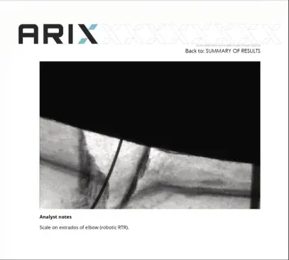 ARIX inspection report page with an RTR image and analyst notes